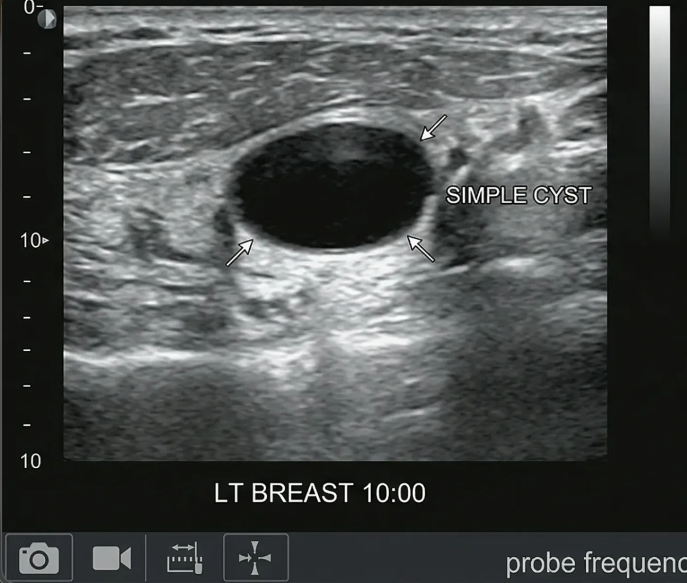 Breast Health